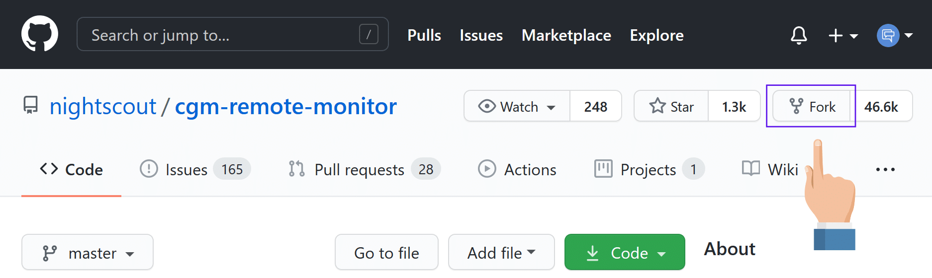 Nightscout - GitHub fork